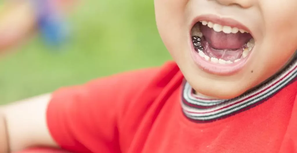 Pediatric Dentistry and Stainless Steel Crowns