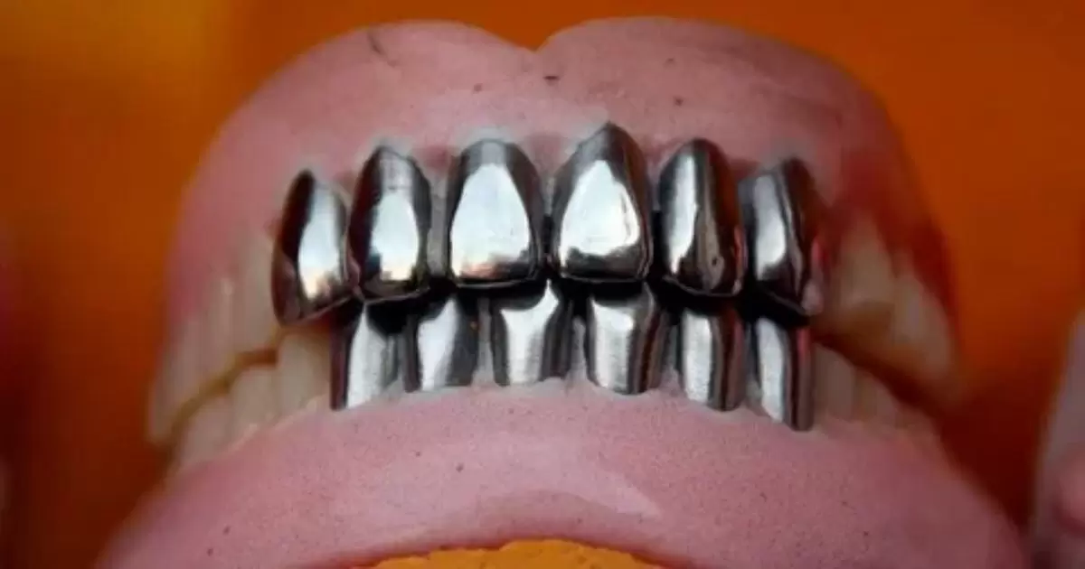 The Art of Contouring Stainless Steel Crowns